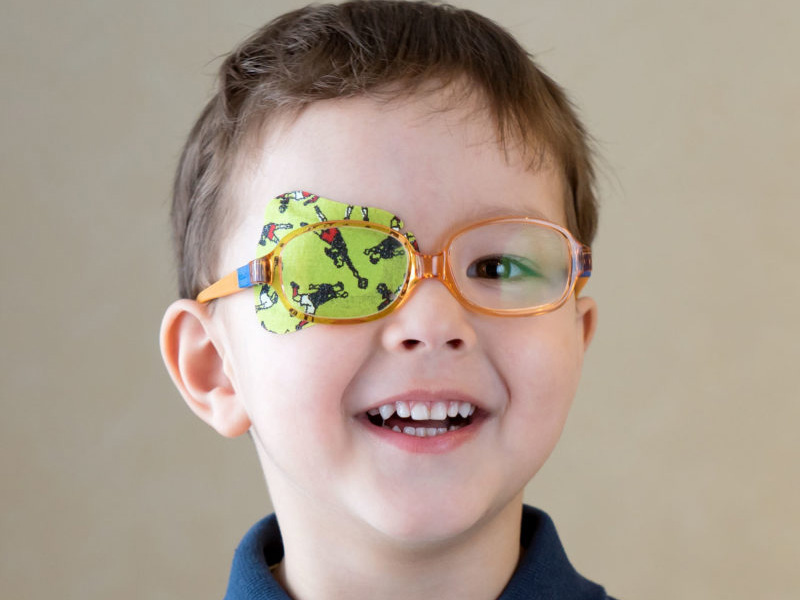 تنبلی چشم در کودکان (Amblyopia)